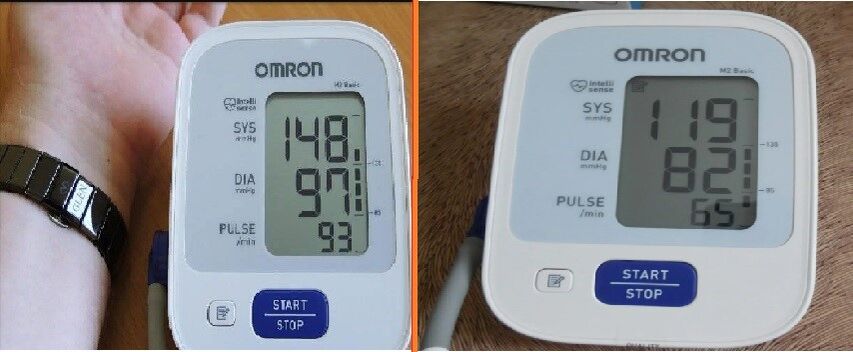 tanometermetingen voor en na het innemen van Cardione